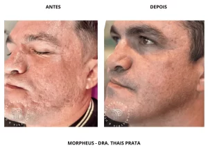 morpheus